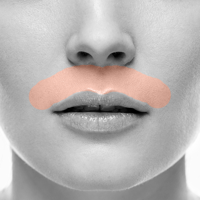 Lip Upper Laser Hair Removal
