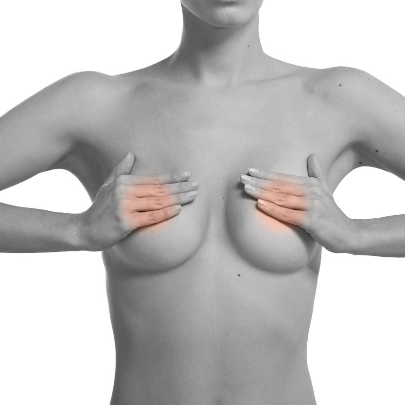 Areola Laser Hair Removal