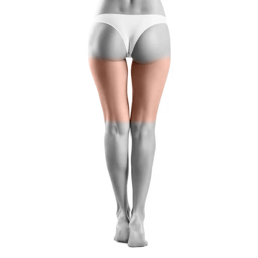 Back of Thighs Laser Hair Removal