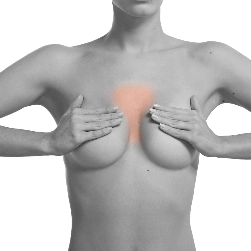 Breastbone Laser Hair Removal