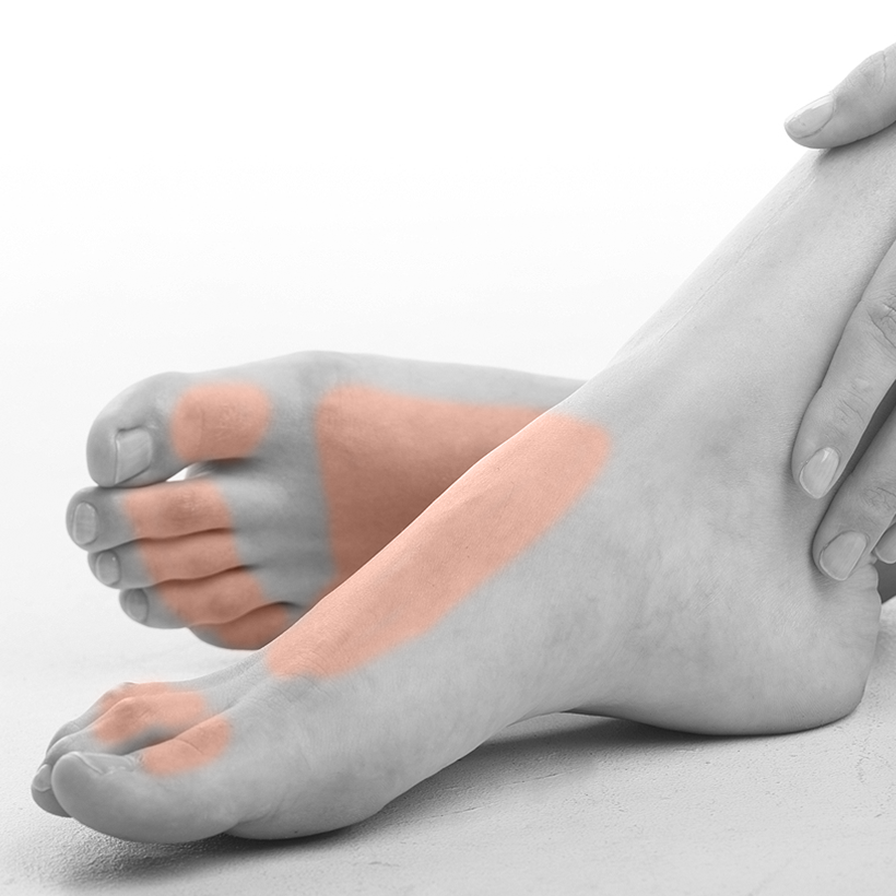 Feet & Toes Laser Hair Removal