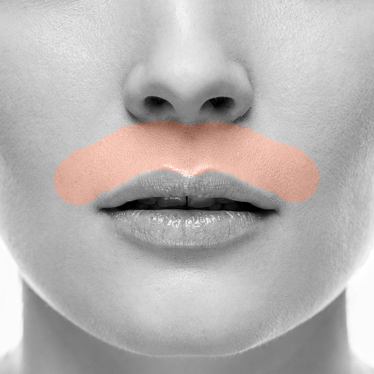 Lip Upper Laser Hair Removal