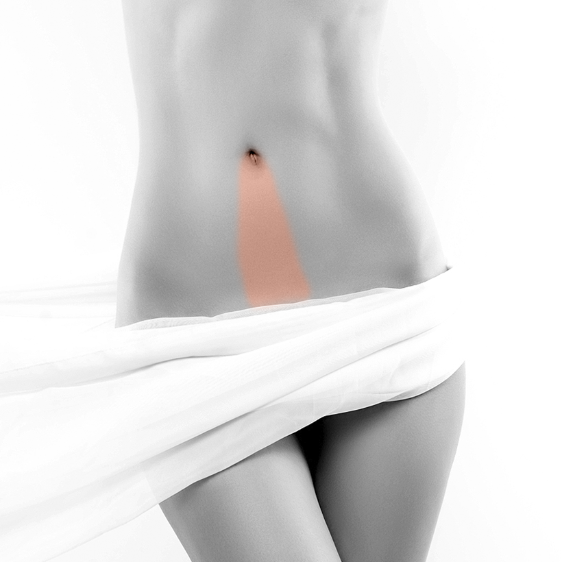 Navel Laser Hair Removal