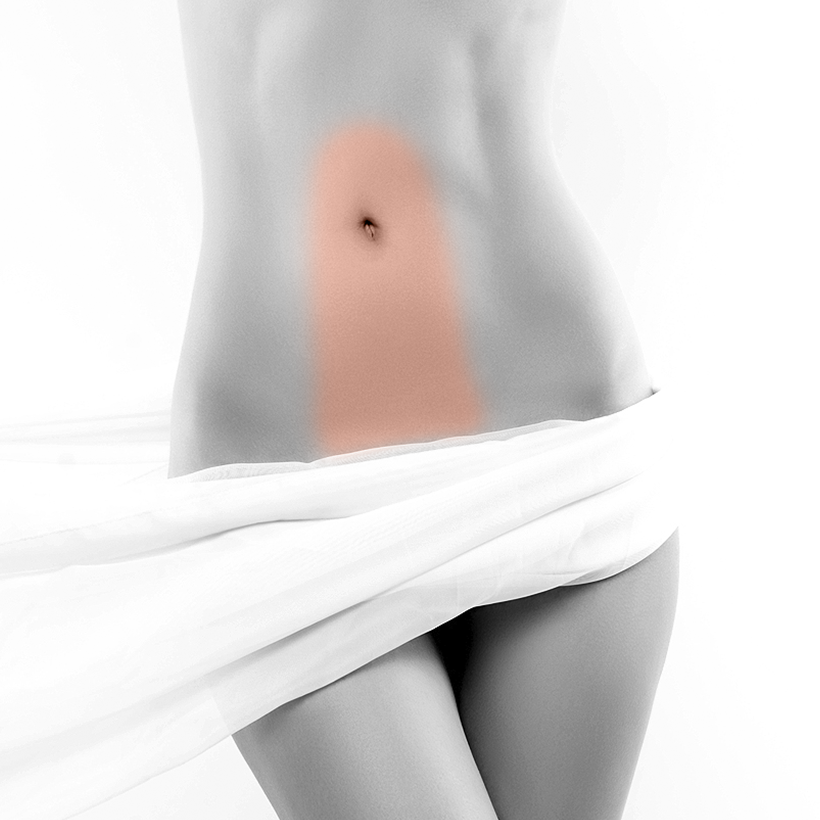 Navel Extended Laser Hair Removal