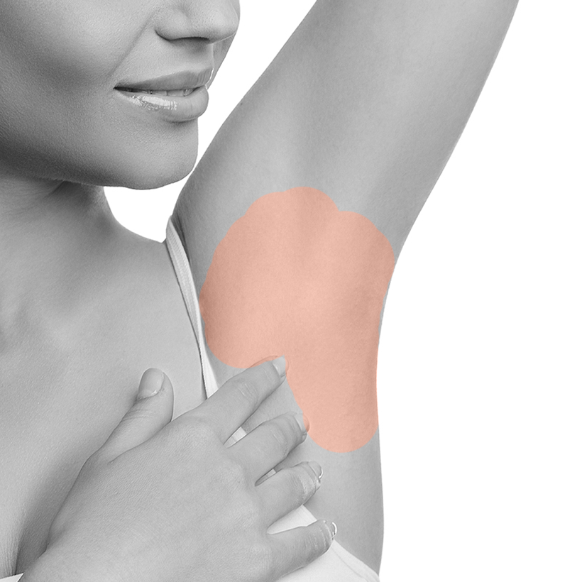 Underarms Laser Hair Removal